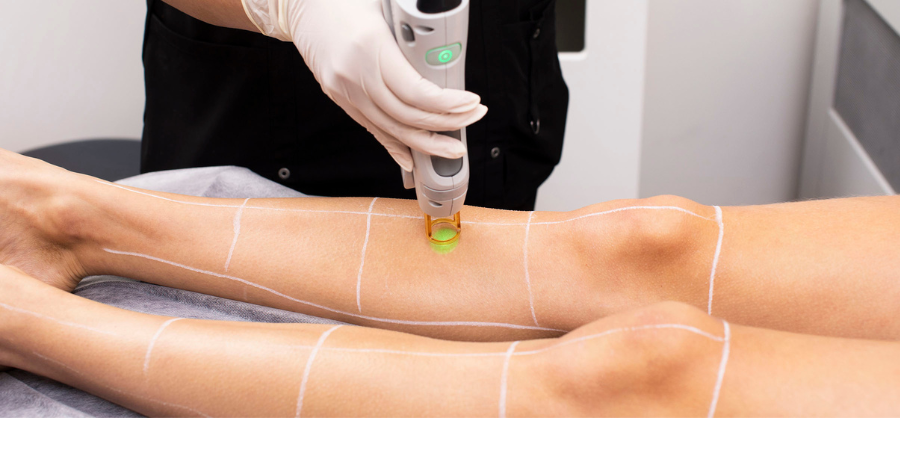 https://www.laserclinics.ca/contentassets/765a52a1bcb1492791967493a7665c05/laser-clinics-why-should-you-do-a-full-body-laser-hair-removal