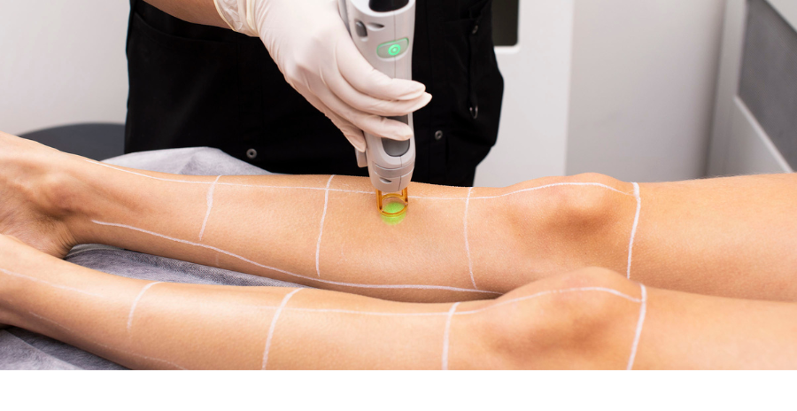 Unlocking the True Cost of Laser Hair Removal Nouvel Age Clinics