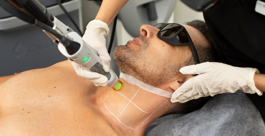 Best Laser Hair Removal