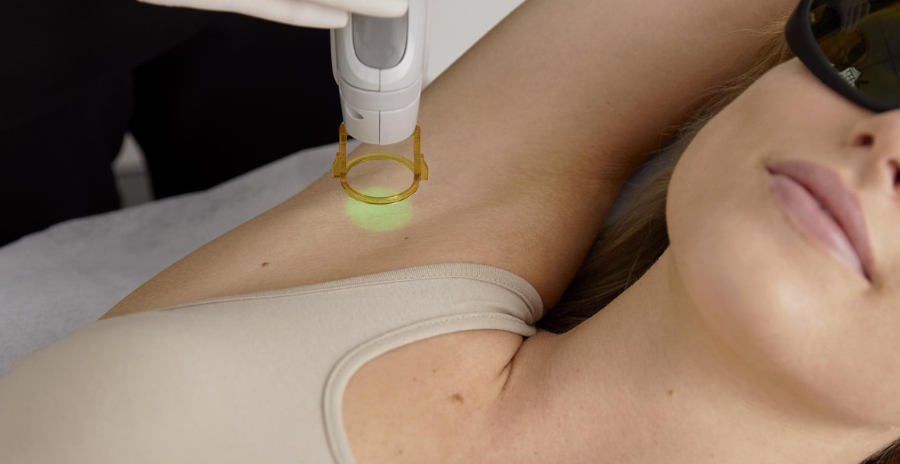 Benefits of Underarms Laser Hair Removal Laser Clinics Canada