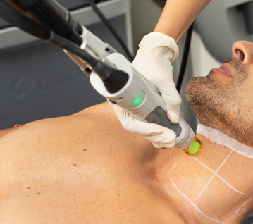 Male laser hair deals removal